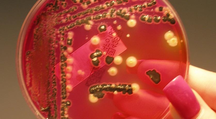 Salmonella may increase risk of colon cancer, research shows